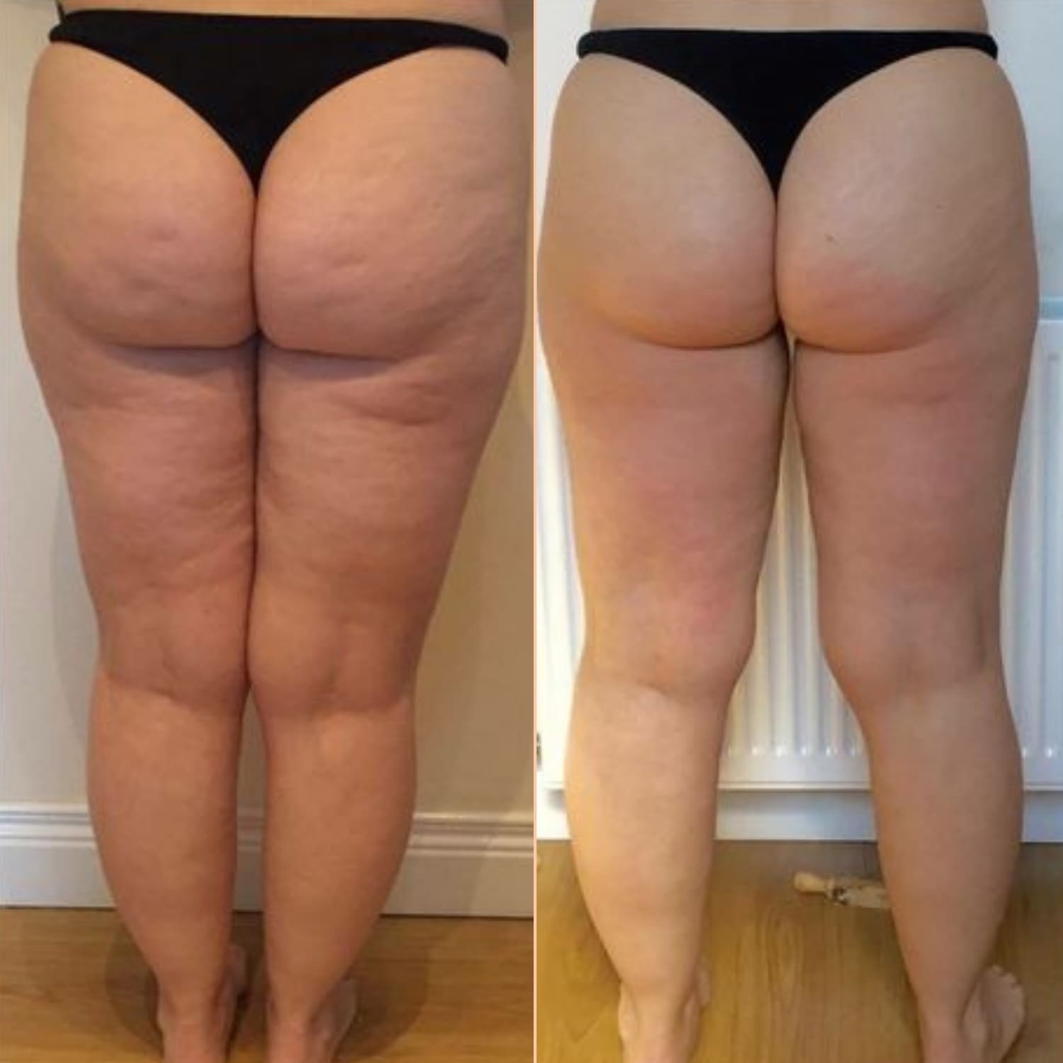 Anti cellulite oil collagen plant stem cells