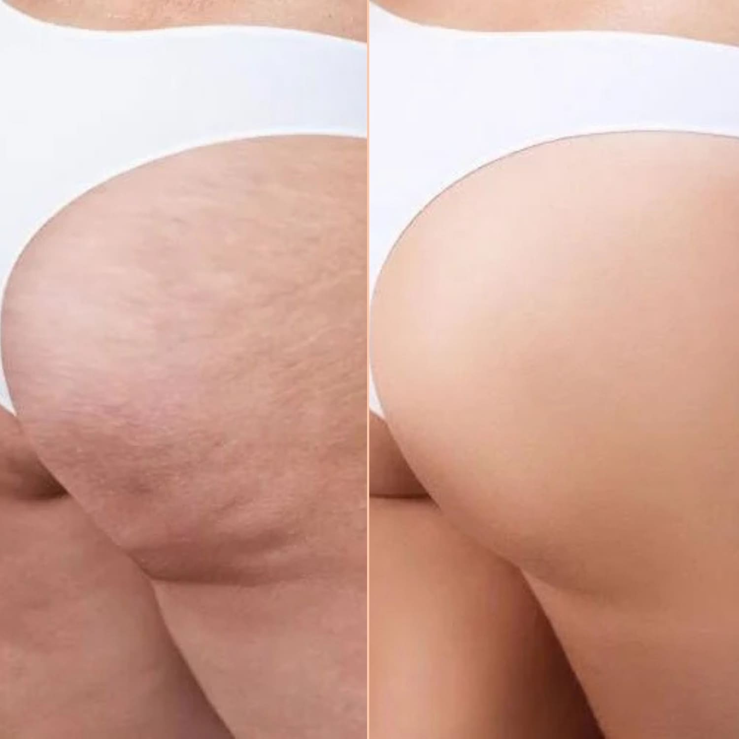 Anti cellulite oil collagen plant stem cells