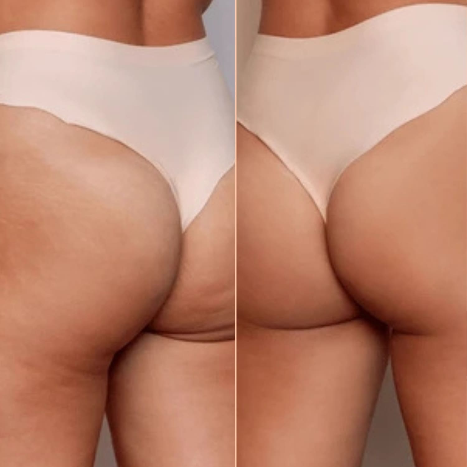 Anti cellulite oil collagen plant stem cells